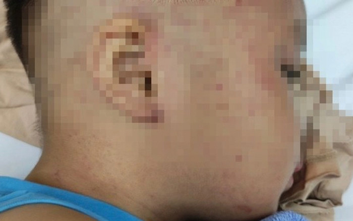 Cấp cứu bé trai 4 tuổi bị bạo hành nhét vào tủ đông Ảnh 2