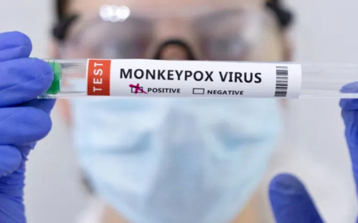 Ca nghi lây nhiễm virus gây bệnh đậu mùa khỉ từ người sang chó đầu tiên được phát hiện Ảnh 2