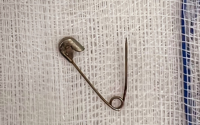 Kim băng phong thủy 'ăn ngon ngủ ngon' suýt đâm thủng dạ dày bé gái 6 tháng tuổi Ảnh 2