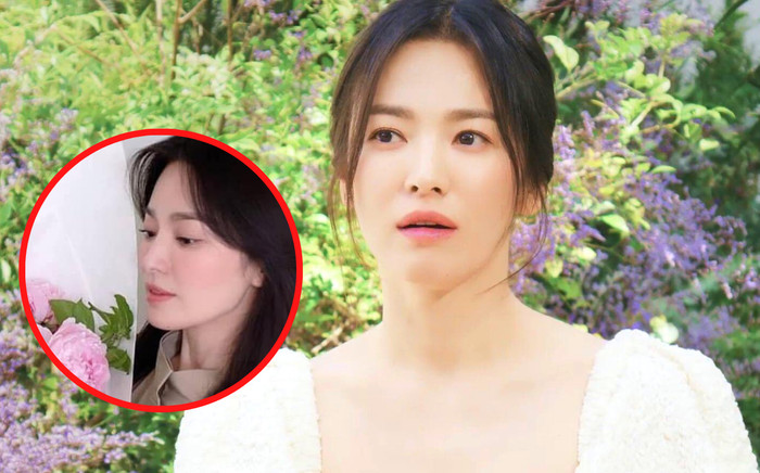 Khán giả lo lắng cho tình trạng hiện tại của Song Hye Kyo Ảnh 2