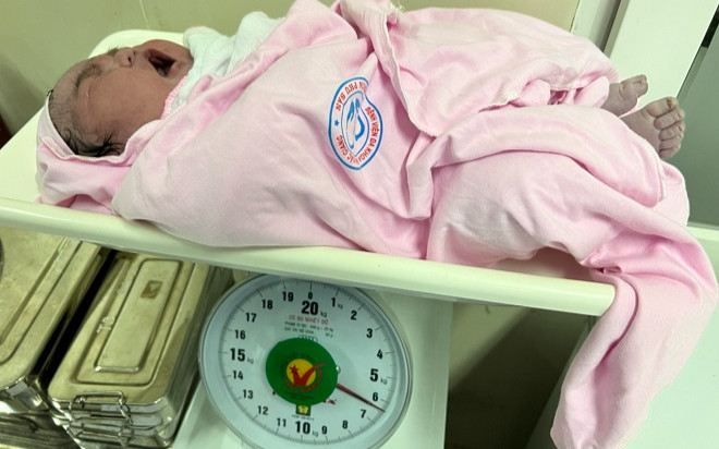 Chuyện hiếm: Bé gái sơ sinh chào đời nặng 6,2kg Ảnh 2