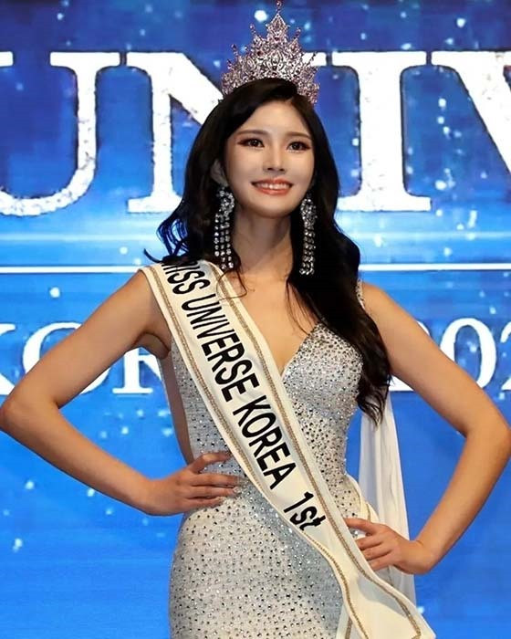 Sắc vóc hiện tại của Miss Universe Korea: Chiều cao khủng có đủ vượt 'Best body' Ngọc Châu? Ảnh 5