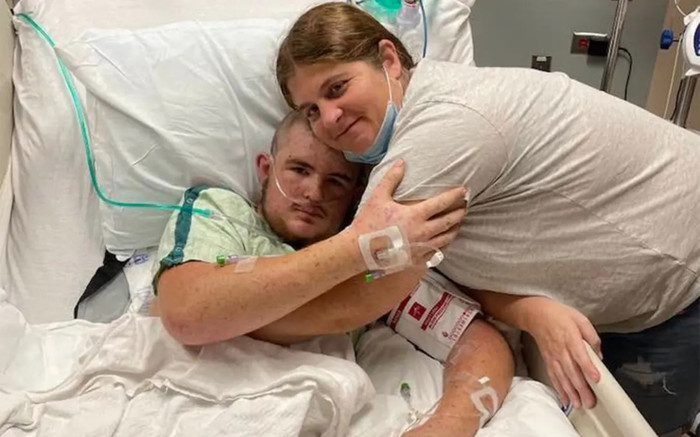 Bị ong sát thủ đốt hơn 20.000 vết, chàng trai trẻ đã thoát khỏi cơn hôn mê Ảnh 2