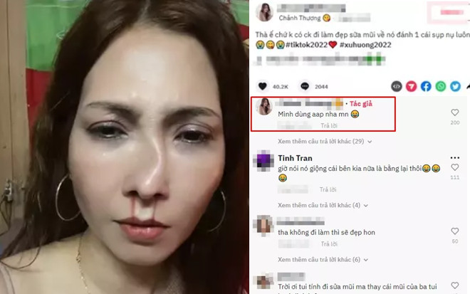 Người phụ nữ đăng đàn tố bị chồng đánh 'tòe mũi' mới nâng và sự thật khiến dân mạng bực mình Ảnh 2