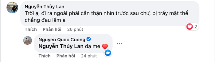 Cường Đô La trầy trụa gương mặt vì tai nạn giao thông, Đàm Thu Trang xót chồng nên ra lệnh cấm Ảnh 3