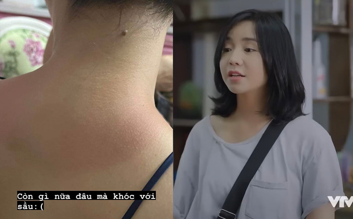 Quỳnh Kool hy sinh vì nghệ thuật, nhìn làn da mà thấy thương! Ảnh 2