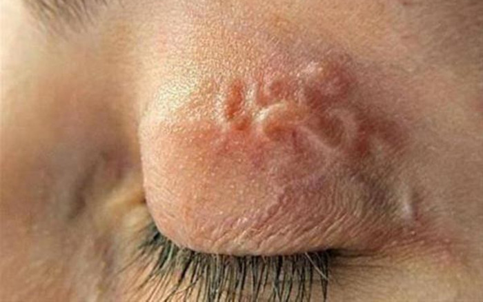 Cô gái 29 tuổi nặng 32kg, phải nhập viện khẩn vì nhiễm giun lươn Ảnh 2