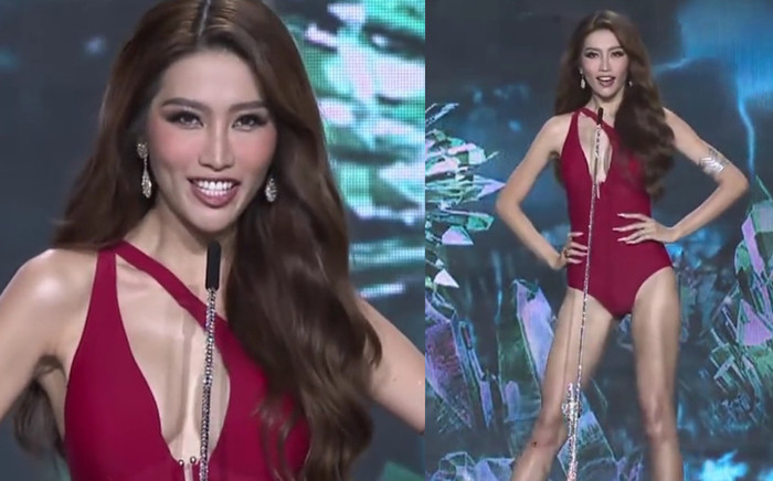 Chế Nguyễn Quỳnh Châu té mạnh trên sân khấu đến chảy máu chân nhưng vẫn cố thi hết mình Ảnh 2