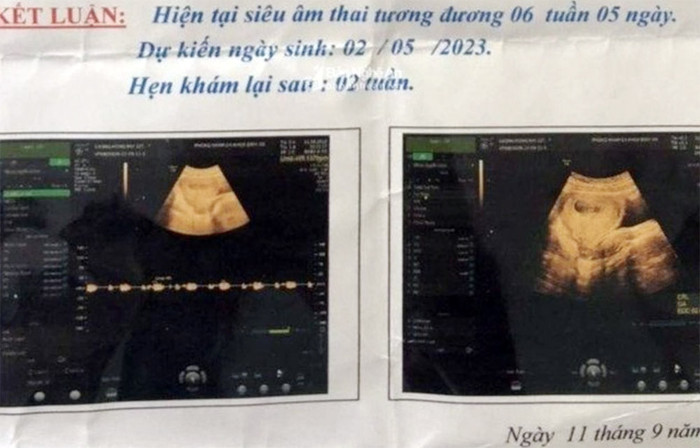 Hình ảnh siêu âm của nữ sinh lớp 6 nghi bị nam bảo vệ xâm hại 