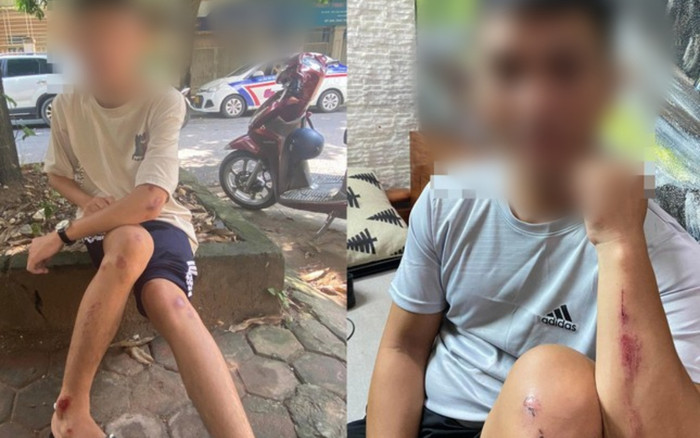 Nhiều người bị nhóm 'tóc xanh, tóc đỏ' vô cớ dùng vỏ chai bia tấn công khi đi đường ở Hà Nội Ảnh 2