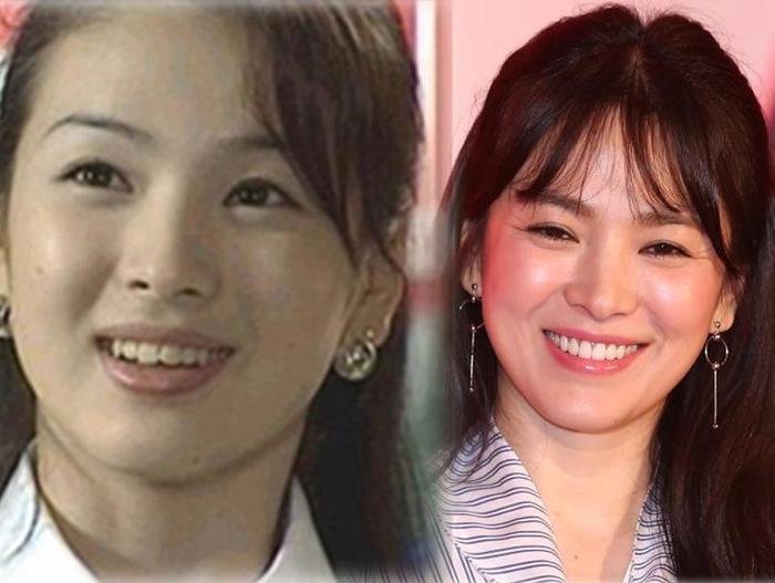 Lộ hình ảnh thời chưa thẩm mỹ của Song Hye Kyo, nhan sắc khác hiện tại một trời một vực Ảnh 2