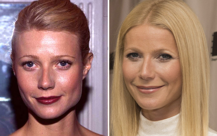 Nhiều ngôi sao quốc tế hối hận vì lạm dụng thẩm mỹ Ảnh 2