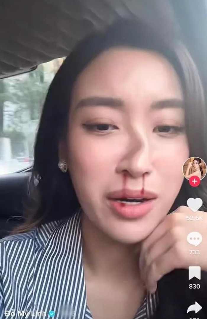 Clip trên đã nhanh chóng thu hút sự quan tâm của công chúng và nhận được hơn 2 triệu views. 