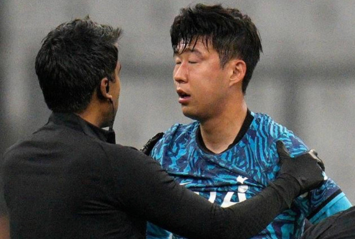 Mắt của Son Heung Min bị sưng.