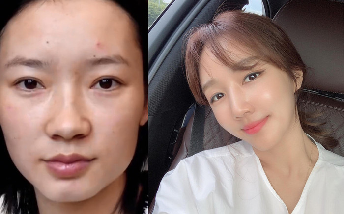 Làn da sau một năm bỏ uống trà sữa của cô gái khiến netizen bất ngờ Ảnh 2