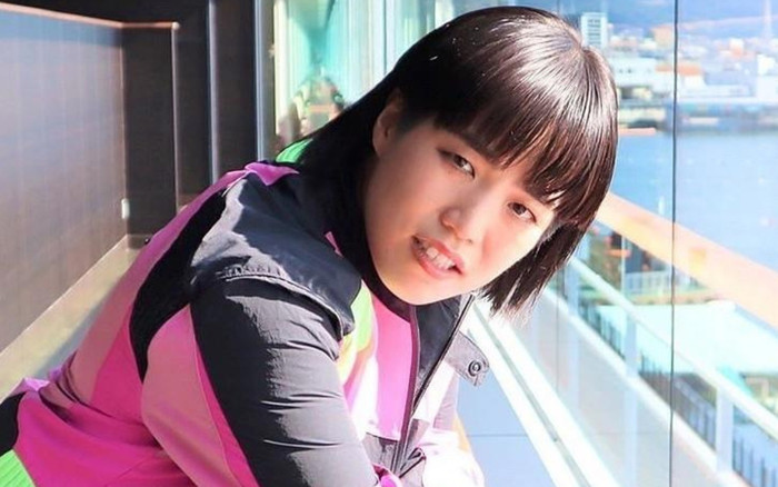 Một nữ diễn viên đình đám chấn thương sọ não vì quay cảnh đập đầu 100 lần Ảnh 2