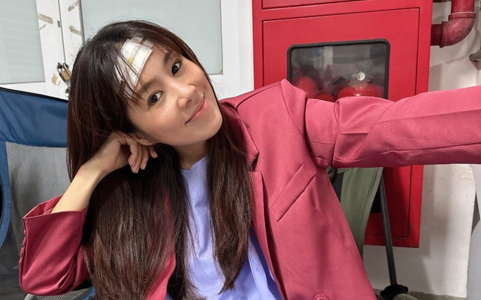 Lê Phương xuất hiện với chân đầy vết bầm khiến khán giả lo lắng Ảnh 2