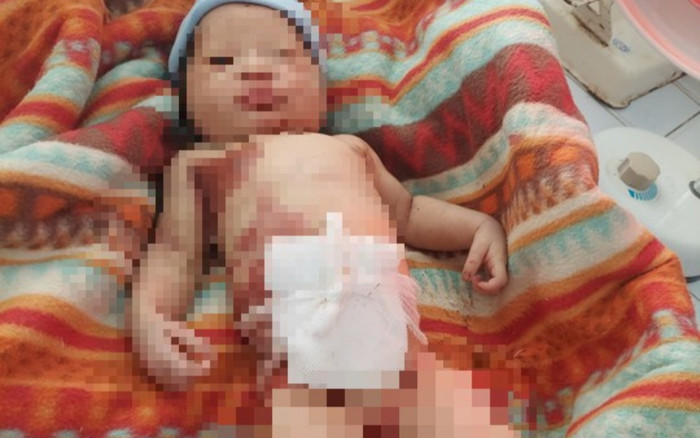 Sức khỏe bé sơ sinh bị bỏ rơi giữa rừng ở Quảng Nam đang chuyển biến xấu Ảnh 2