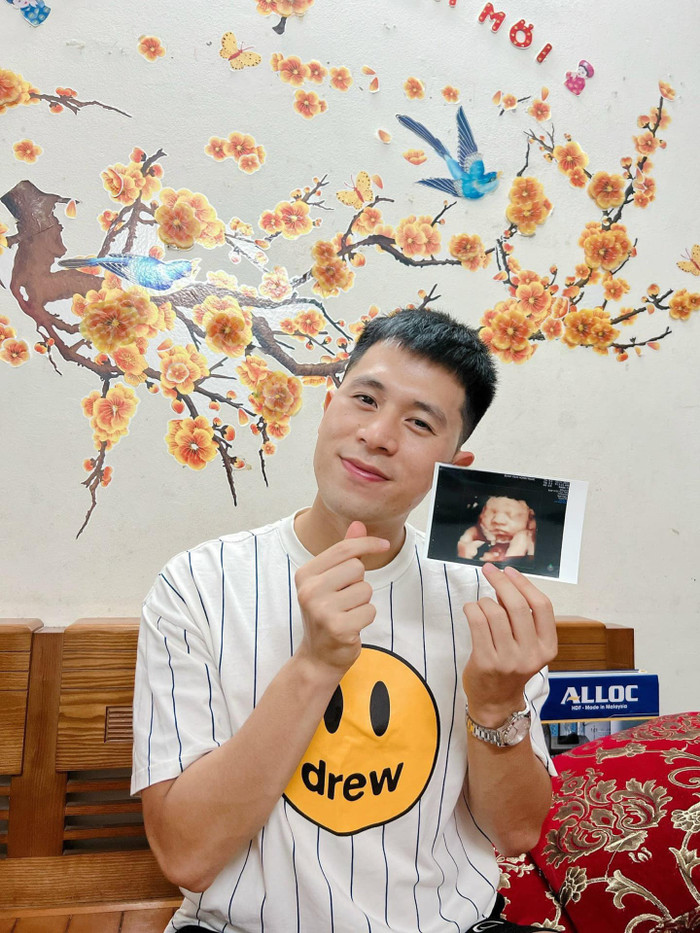 Đình Trọng khoe hình ảnh siêu âm của con đầu lòng
