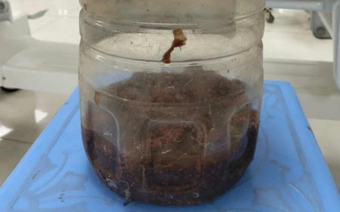 Hai người đàn ông nhập viện khẩn sau khi uống rượu ngâm thứ mà nhiều người tưởng như vô hại Ảnh 2