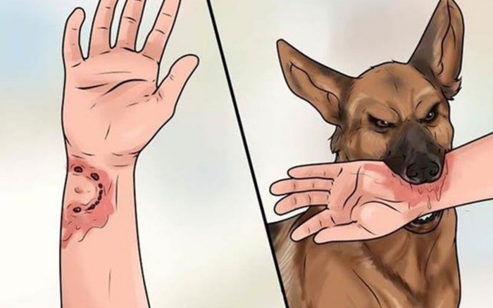 Sau 2 tháng bị chó cắn, người đàn ông ở Hà Nội tử vong sau ít ngày vào viện Ảnh 2