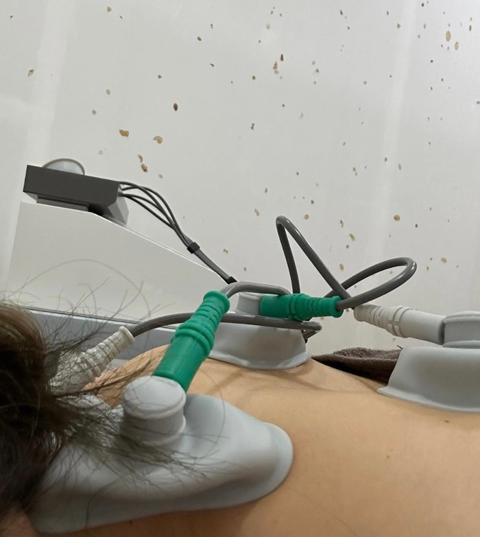 Hari Won tiết lộ tình trạng sức khỏe hiện tại, phải đi châm cứu mỗi ngày Ảnh 1