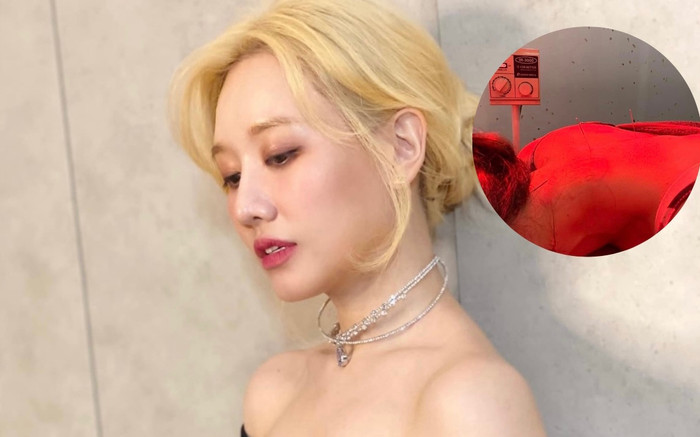 Hari Won tiết lộ tình trạng sức khỏe hiện tại, phải đi châm cứu mỗi ngày Ảnh 2