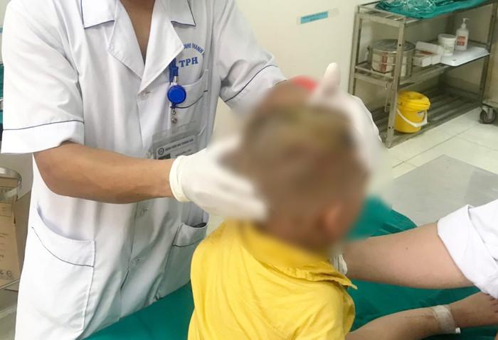Các bác sĩ kiểm tra vết thương cháu bé. (Ảnh: BV Nhi Thanh Hóa).