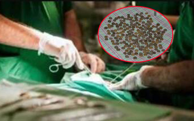 Bác sĩ chụp X-quang sốc nặng trước 'kho báu' trong bụng người đàn ông Ảnh 2