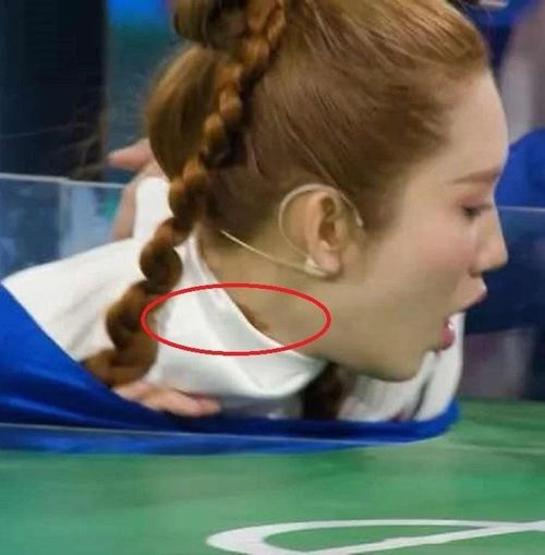 Thúy Ngân phải tạm gác lại một số hoạt động nghệ thuật để điều trị vết thương ở cổ.