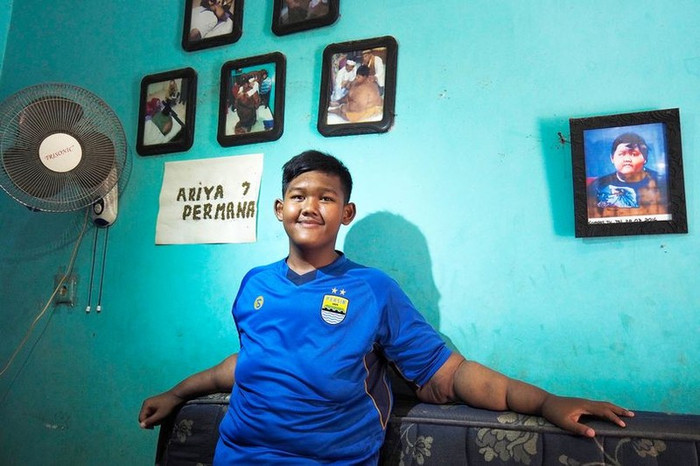 Màn 'lột xác' khó tin của cậu bé béo nhất thế giới Ảnh 3