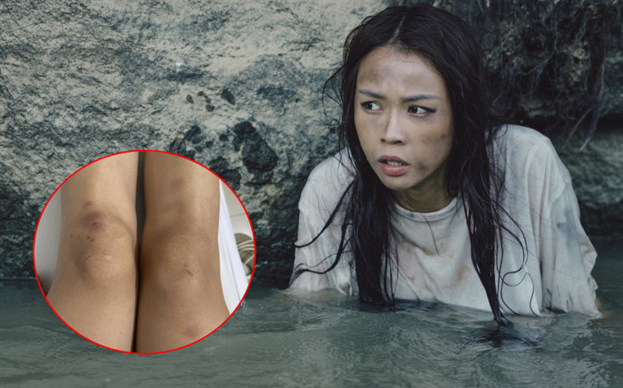 Sam khiến khán giả xót xa với khuôn mặt sưng vù, tay chân đầy vết thương lúc đóng phim Ảnh 2