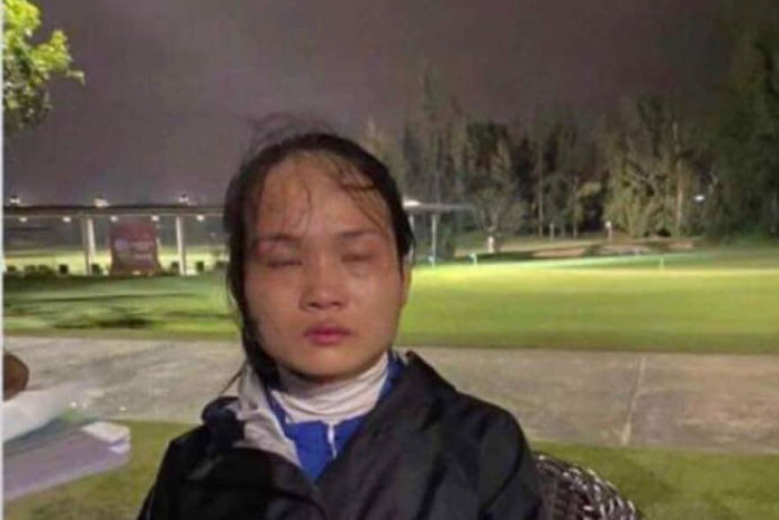 Chị L. bị đánh bằng gậy golf. (Ảnh F.B.).
