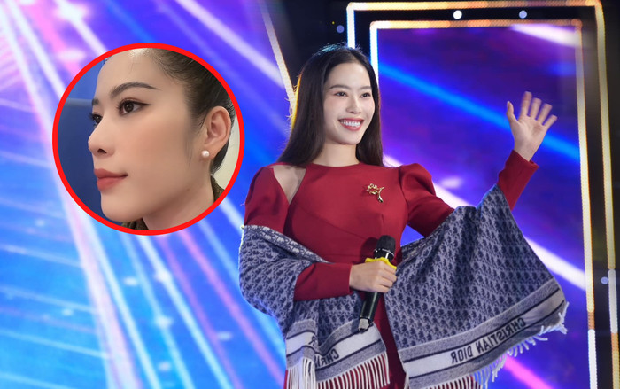 Netizen chỉ ra một điểm trên gương mặt bị nghi là lí do khiến Nam Em lận đận tình duyên Ảnh 2