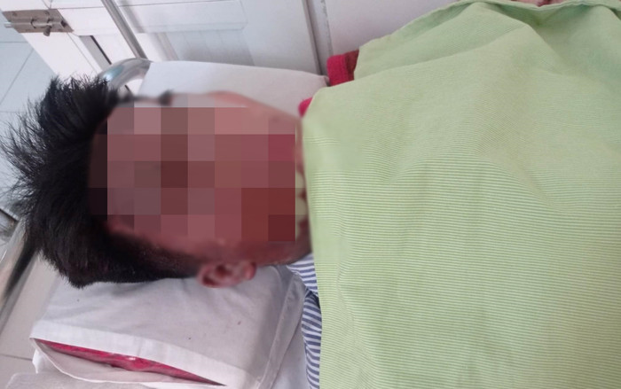 Đi làm thêm về, nam sinh viên bị tạt kiềm đặc thủng giác mạc tại Hà Nội Ảnh 2