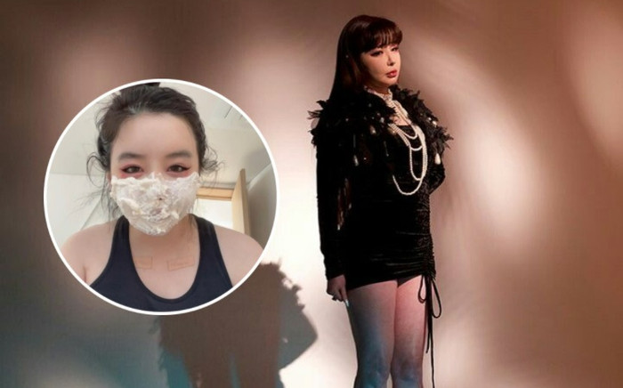 Park Bom (2NE1) để lộ dấu tích lạ trên cơ thể khiến người hâm mộ lo lắng Ảnh 2