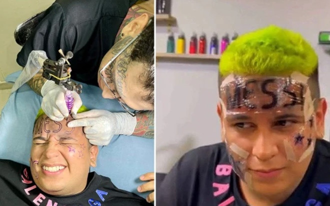 Chịu đau 'cắt da cắt thịt' xăm tên Messi lên trán, fan 'cuồng' vẫn bị dân mạng chỉ trích Ảnh 2