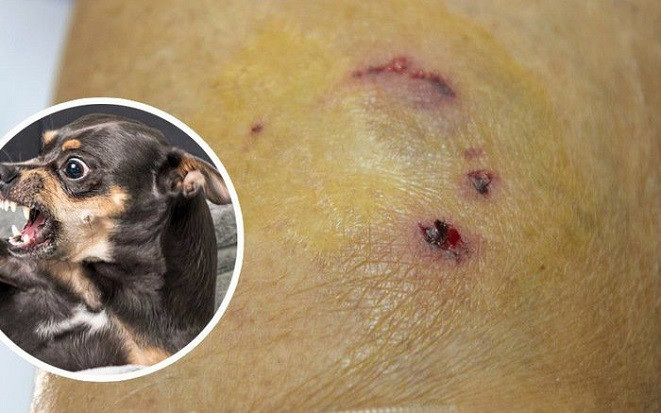 Bị chó cắn bắt luôn làm thịt, người đàn ông trả giá đắt sau 4 tháng Ảnh 2