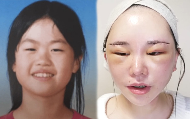 Diện mạo 'bất ngờ' của nữ idol Nhật sau 12 năm chi tiền tỷ làm phẫu thuật để 'giống người thường' Ảnh 2