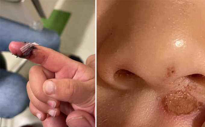 Trương Hằng tố Trịnh Sảng bạo hành con cái bằng việc đăng tải video vết thương và việc các bé nói sợ, không muốn gặp mẹ. 