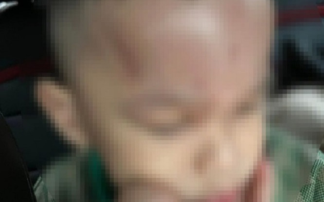 Đà Nẵng: Giao công an vào cuộc xác minh vụ phụ huynh phản ánh con trai bị bạo hành tại trường mầm non Ảnh 2