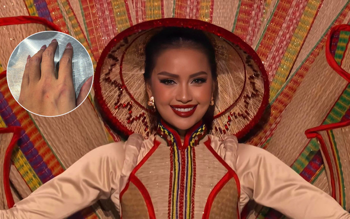 Ngọc Châu bầm dập sau bán kết Miss Universe 2022 Ảnh 2