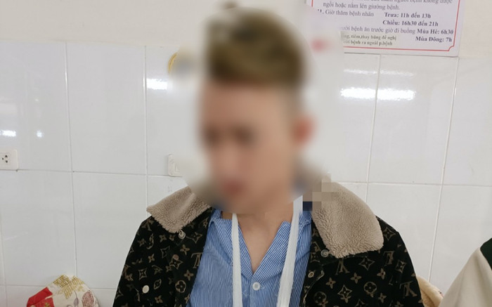 Đốt pháo tự chế ngày Tết, thanh niên 22 tuổi nhập viện khẩn Ảnh 2