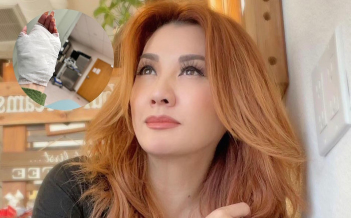 Vừa đầu năm mới, một nữ ca sĩ gặp tai nạn, một mình lái xe vào viện Ảnh 2