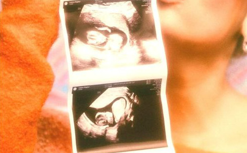 Nữ ca sĩ được mệnh danh 'bà hoàng TikTok' bất ngờ thông báo đang mang thai em bé thứ 2 Ảnh 2