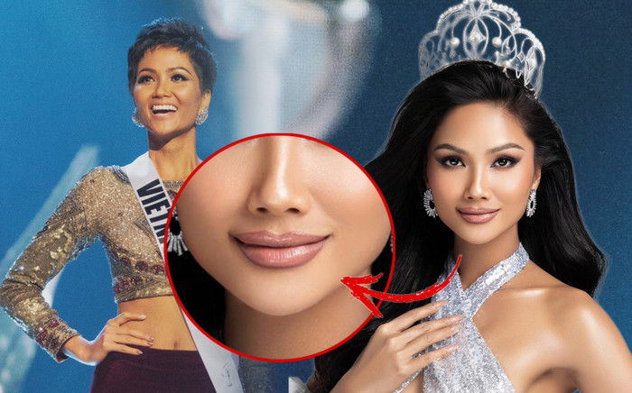 Vừa được fan quốc tế nhắc, H'Hen Niê lộ điểm 'sưng vù' trên khuôn mặt: Đã can thiệp thẩm mỹ? Ảnh 2