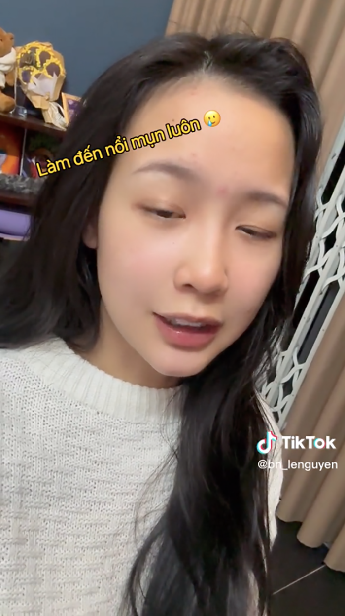 Dù mặt nổi mụn, song diện mạo cùng thần thái của nàng Hậu vẫn nhận được 'mưa lời khen' từ dân mạng.
