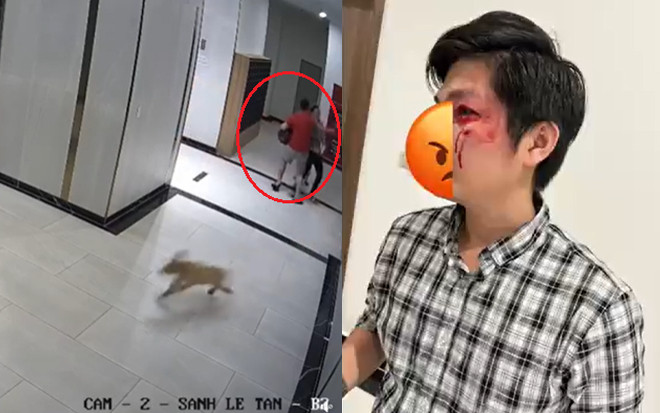 Bảo vệ bé trai khỏi chó dữ, thanh niên bị đấm 'nát mặt' Ảnh 2