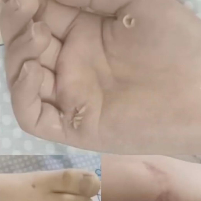 Những vết thương của nạn nhân sau khi tử vong