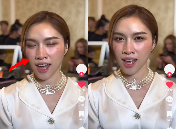 Chiếc mũi của Miss Charm Vietnam 2023 có dấu hiệu bị lệch sang một bên khi ống kính bắt cận mặt. Một số bộ phận mạng cho rằng nữ MC '3000 chữ' đã sử dụng biện pháp nâng mũi để có một vẻ ngoài hoàn hảo hơn, nhưng một bên cánh mũi lại không cân đối. 